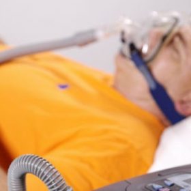 Hội chứng ngưng thở khi ngủ